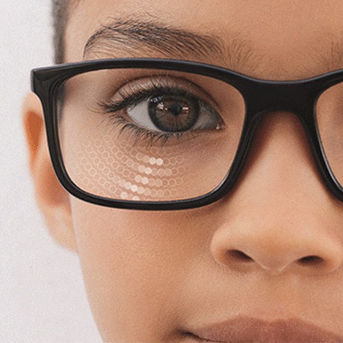 What Are Myopia Control Lenses?